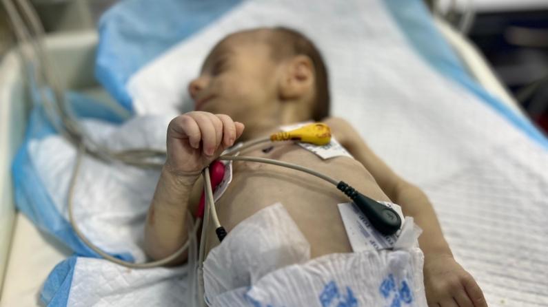 Aufgrund von Unterernährung kämpft Baby Leyla in Gaza ums Überleben